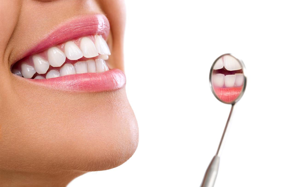 igiene orale bergamo